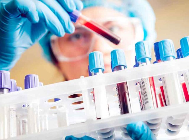 provette analisi del sangue