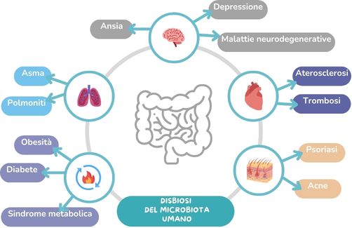 EUBIOME_GUT_brochure.pdf (3) cause DISBIOSI DEL MICROBIOTA UMANO